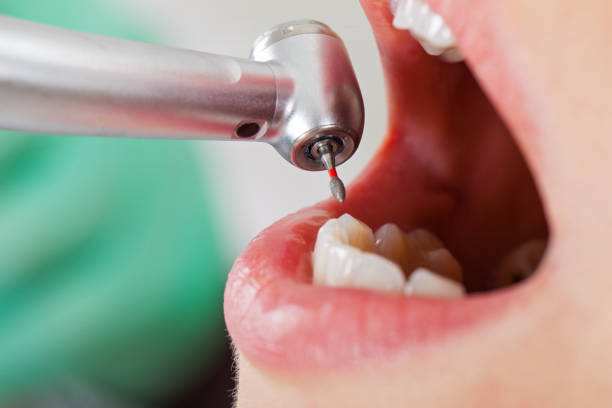 Best Emergency Treatment for Toothache in Ottawa Hills, OH